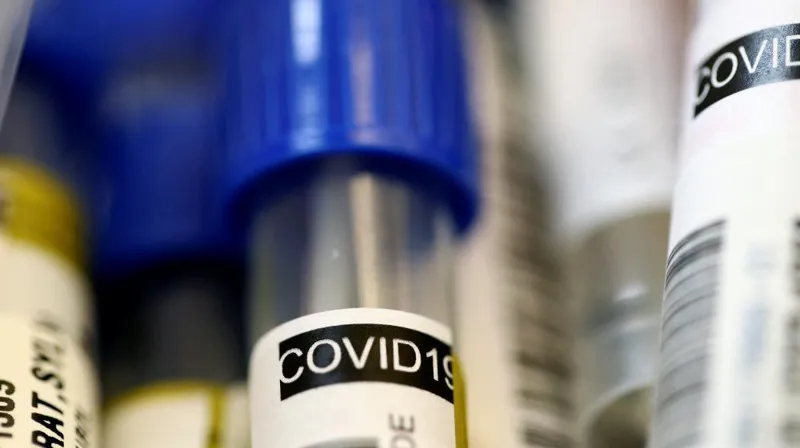 Number of coronavirus cases increases to 85 in Georgia