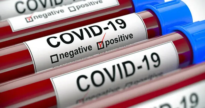 Georgia reports 887 new cases of coronavirus