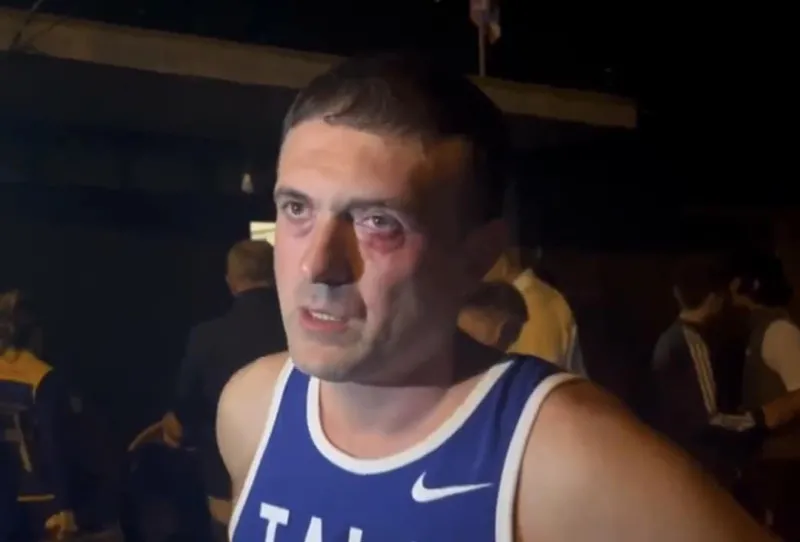 Irakli Edzgveradze, deputy of the National Movement of the City Council, was assaulted