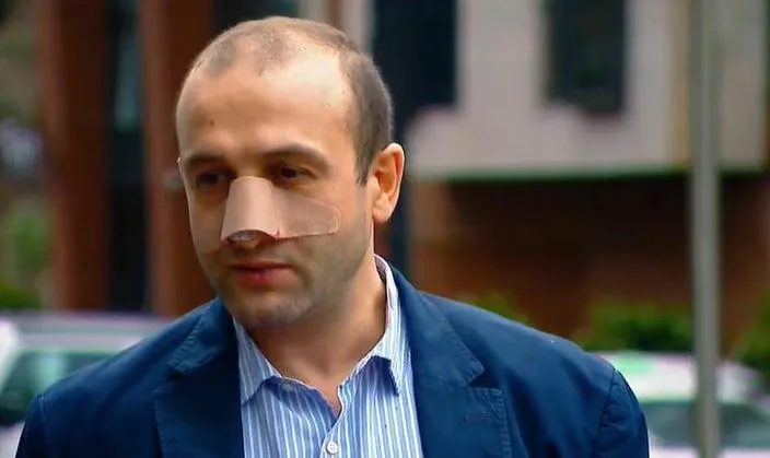 Iago Khvichia says he was physically abused at Girchi office