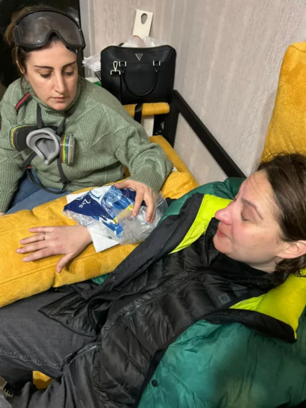 Members of "Coalition for Change" were injured during the break-up of the ongoing rally on Rustaveli Avenue
