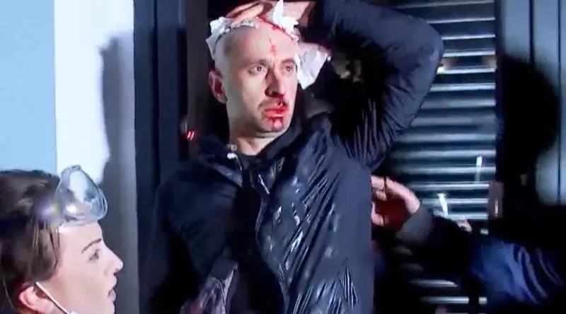 "Center for the Study of Democracy" - 33 journalists were physically assaulted during the protests held on Rustaveli Avenue on November 28-29