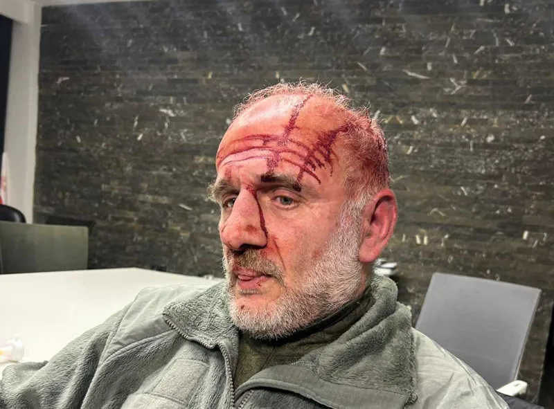 Koba Khabazi speaks about the details of the attack on him