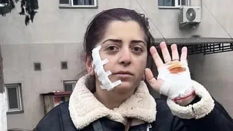 An employee of a public school in Bolnisi, who was attacked by an unknown person, states that she was provided with medical assistance, and an investigation has been launched into the incident
