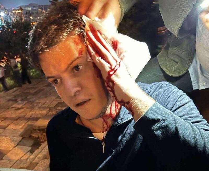 国家运动的副主席伊戈尔·纳尔马 尼亚遭到袭击。