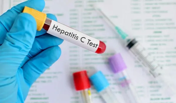 Վերջին 10 տարվա ընթացքում հեպատիտ C-ի  բուժման կարիք ունեցող 107,200 մարդկանցից 92,910-ը ընդգրկվել է բուժման ծրագրում, որոնցից 98.1%-ը արդեն բուժվել է