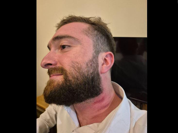 与泰拉维酒店婚礼期间事件有关的被捕者律师谈论事件细节