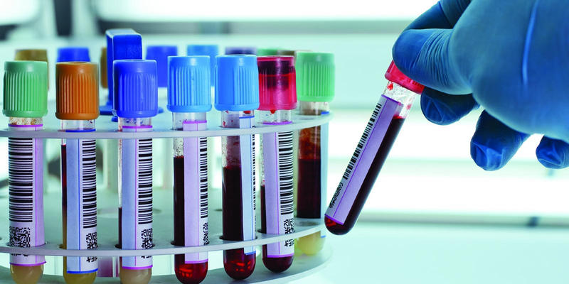 კოვიდსასტუმროში მოთავსებული პაციენტებისთვის ე.წ. D დიმერისა და სისხლის საერთო ანალიზების ჩატარება დაიწყო, ბინაზე მყოფი კოვიდინფიცირებულების შემთხვევაში კი გადაწყვეტილებას ექიმი იღებს