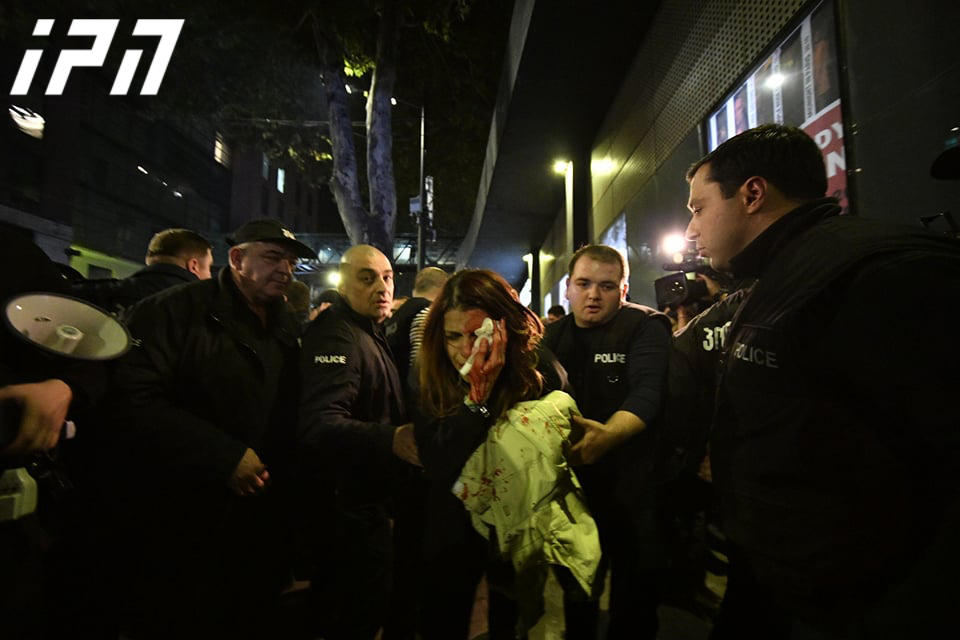 Civil activist injured outside Amirani Cinema