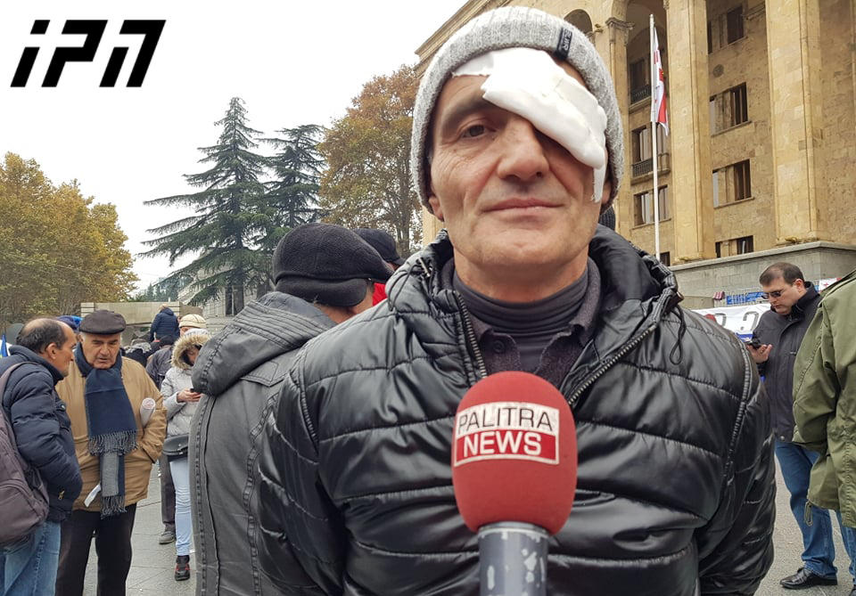 აქციის მონაწილე ზაზა ლიპარტელიანი აცხადებს, რომ წყლის ჭავლისგან თვალის დაზიანება მიიღო