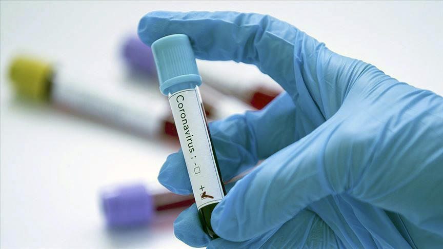 თბილისის მედიცინის ინსტიტუტის ერთ-ერთ თანამშრომელს კორონავირუსი დაუდასტურდა