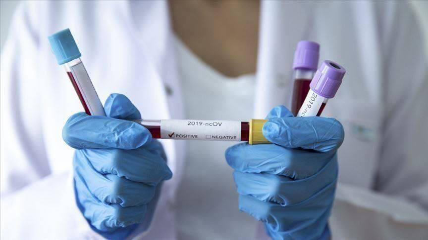 Occupied Abkhazia reports 1 new case of coronavirus