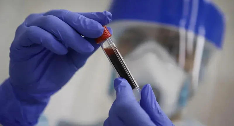 აშშ-ში კორონავირუსის 45 242 ახალი შემთხვევა დადასტურდა, რაც ინფიცირების რეკორდული დღიური მაჩვენებელია