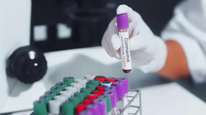 В Грузии выявлено 9 новых случаев коронавируса, выздоровели же 4 человека