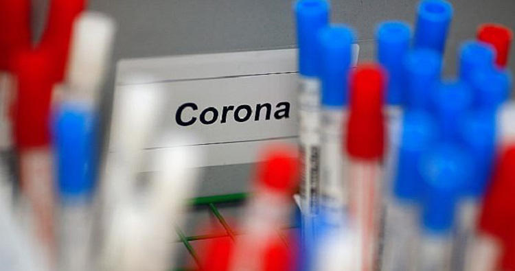 აშშ-ში კორონავირუსის 24 362 ახალი შემთხვევა დადასტურდა და 265 ადამიანი გარდაიცვალა