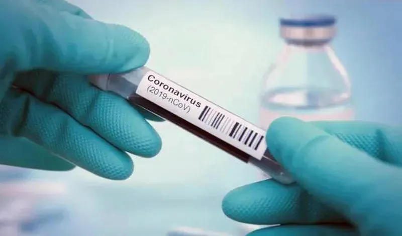 თბილისის 82-ე სკოლის მოსწავლეს კორონავირუსი დაუდასტურდა