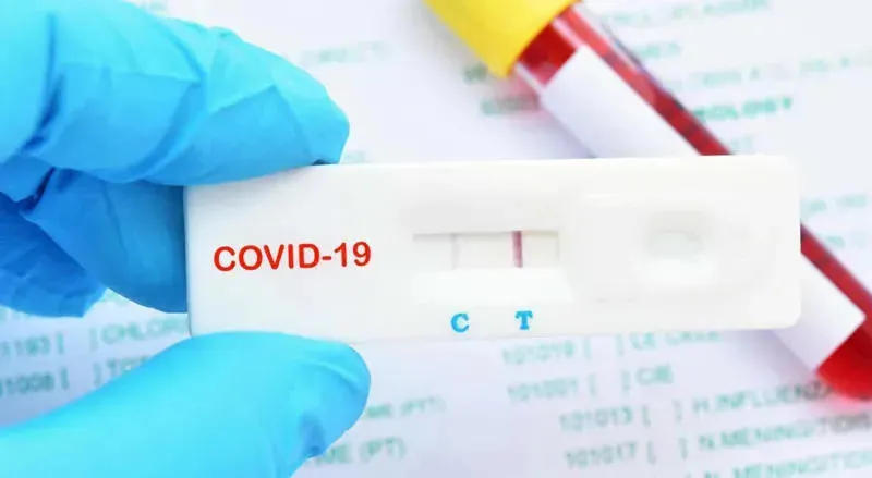 ქუთაისის #59-ე საოლქო კომისიის თავმჯდომარეს კორონავირუსი დაუდასტურდა