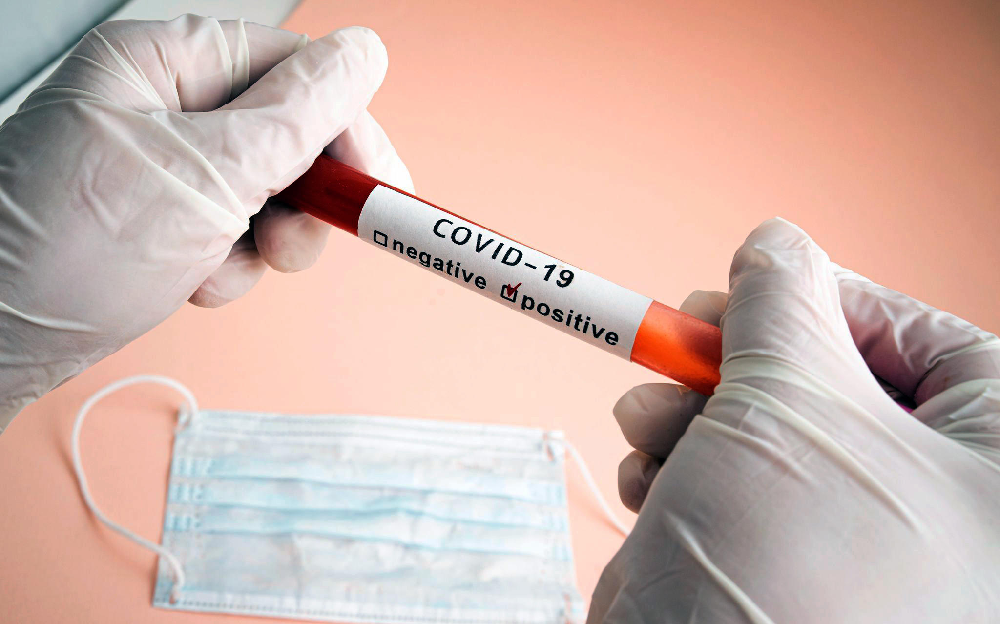 საქართველოში კორონავირუსის 2775 ახალი შემთხვევა დაფიქსირდა, საიდანაც 1044 თბილისში, 503 აჭარაში და 526 იმერეთში გამოვლინდა