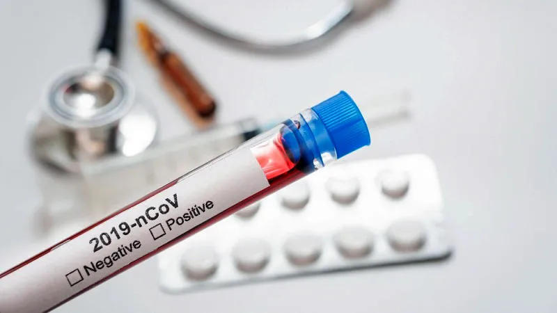 Occupied Abkhazia reports 68 new cases of coronavirus
