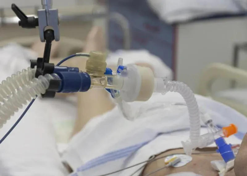 В Грузии в тяжелом состоянии 1 104 инфицированных коронавирусом пациента, 417 из них на искусственном дыхании