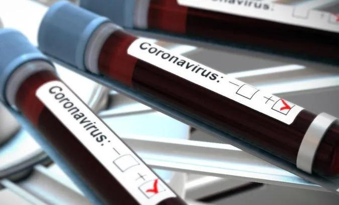 საქართველოში კორონავირუსის 2635 ახალი შემთხვევა გამოვლინდა, საიდანაც 1134 - თბილისში, 230 - აჭარაში, 338 კი - იმერეთში დაფიქსირდა