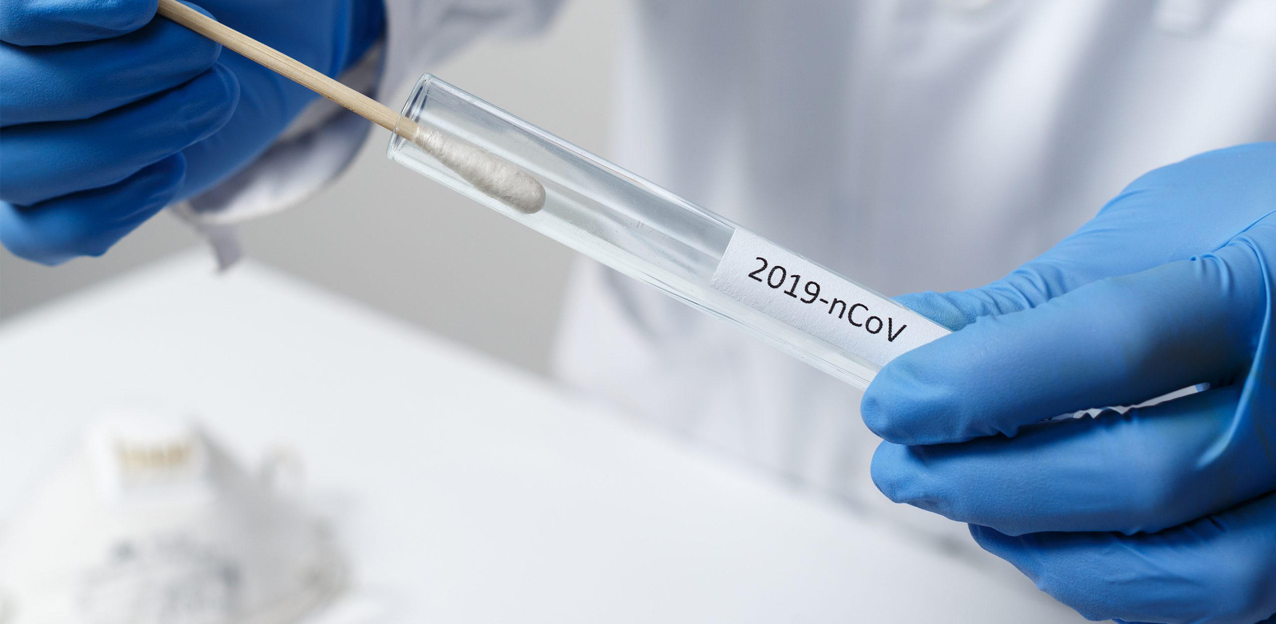 В Грузии выявлено 1 618 новых случаев инфицирования коронавирусом, в стране за последние 24 часа проведено 19 438 тестов