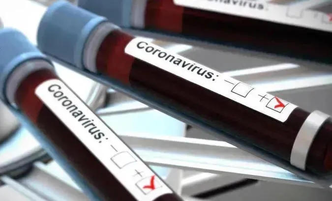 საქართველოში კორონავირუსით ინფიცირების 337 ახალი შემთხვევა გამოვლინდა, ქვეყანაში ბოლო 24 საათში 25 436 ტესტი ჩატარდა