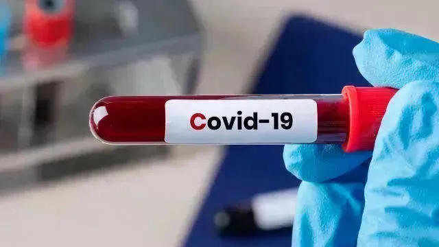 საქართველოში კორონავირუსით ინფიცირების 2 616 ახალი შემთხვევა გამოვლინდა, ბოლო 24 საათში 36 375 ტესტი ჩატარდა