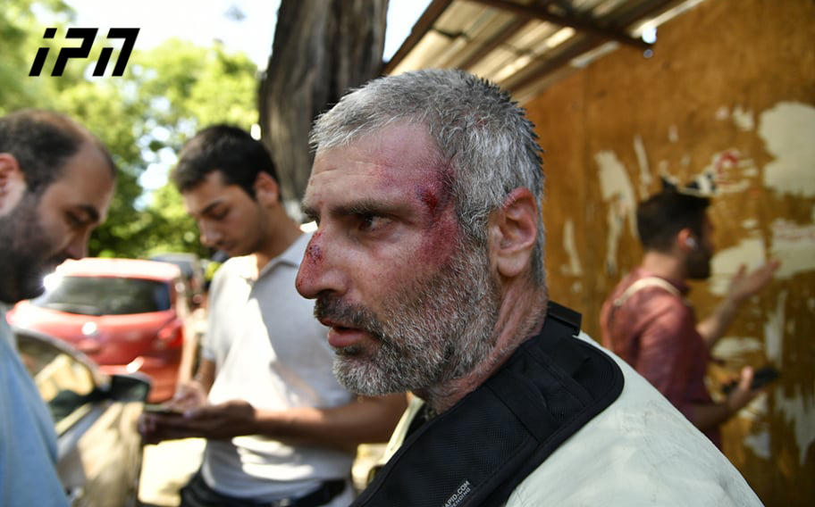 „ღირსების მარშის“ მოწინააღმდეგეები „ინტერპრესნიუსის“ ფოტოკორესპონდენტს ფიზიკურად გაუსწორდნენ