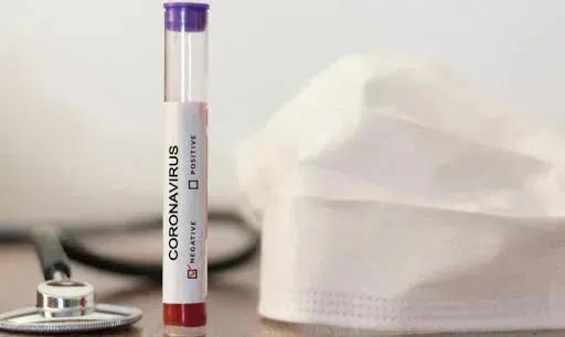 В Армении зафиксировано 507 новых случаев коронавируса, умерли 14 человек