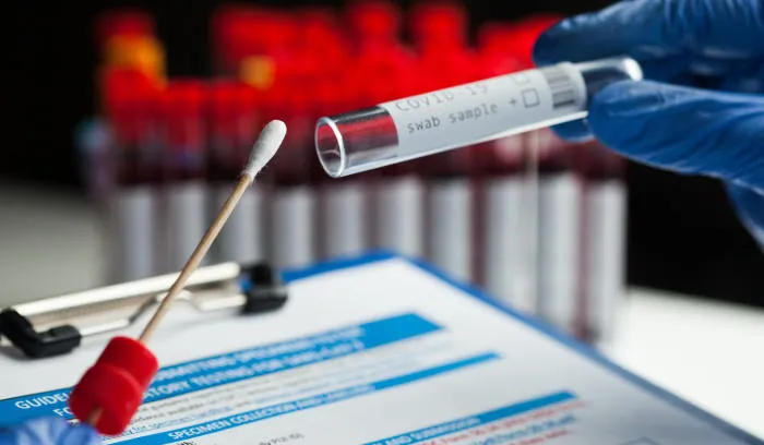 მსოფლიოში კორონავირუსით ინფიცირებულთა საერთო რაოდენობამ 373 მილიონს გადააჭარბა