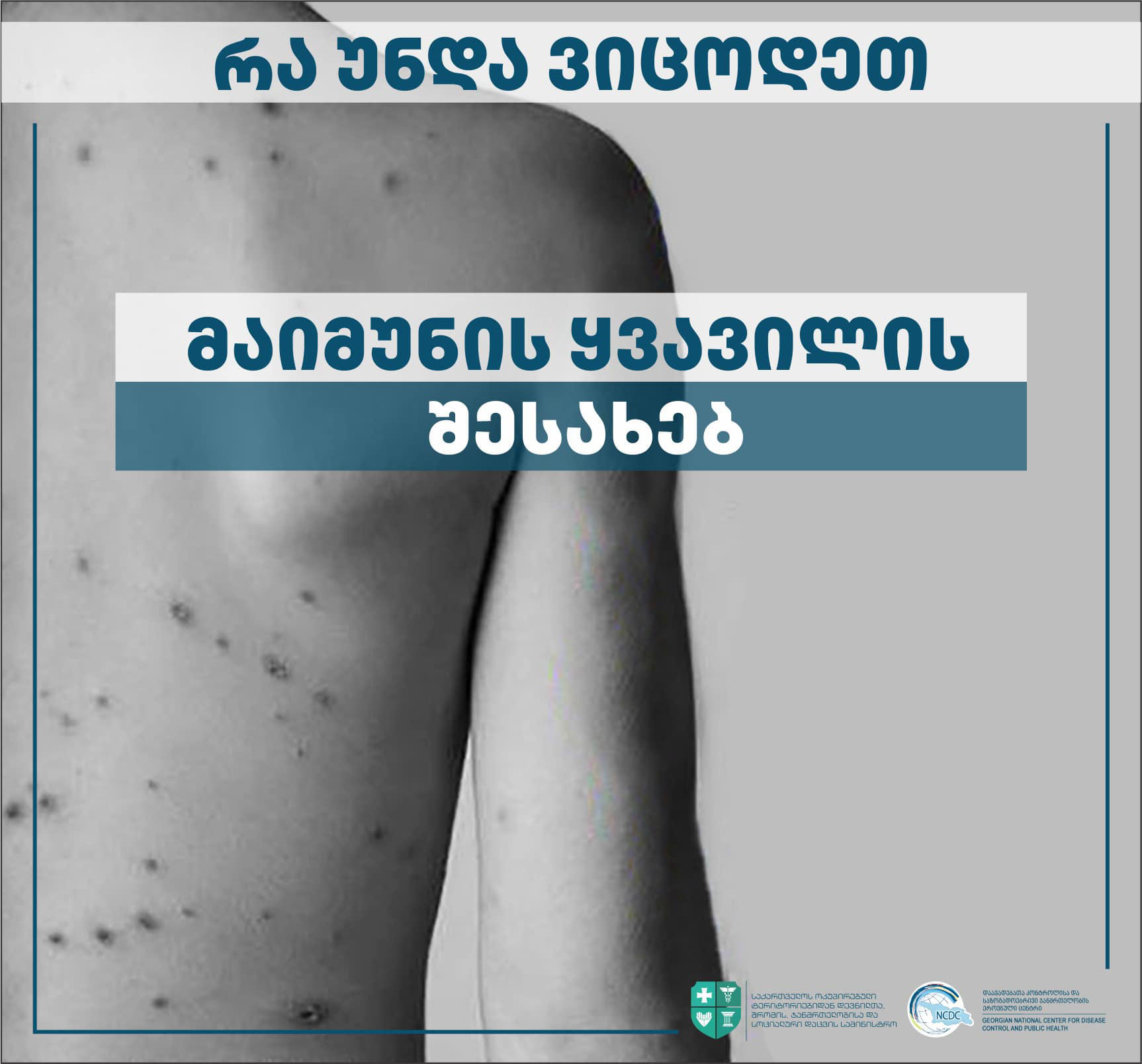 დაავადებათა კონტროლის ცენტრი  „მაიმუნის ყვავილთან“ დაკავშირებით მოსახლეობას ინფორმაციას აწვდის