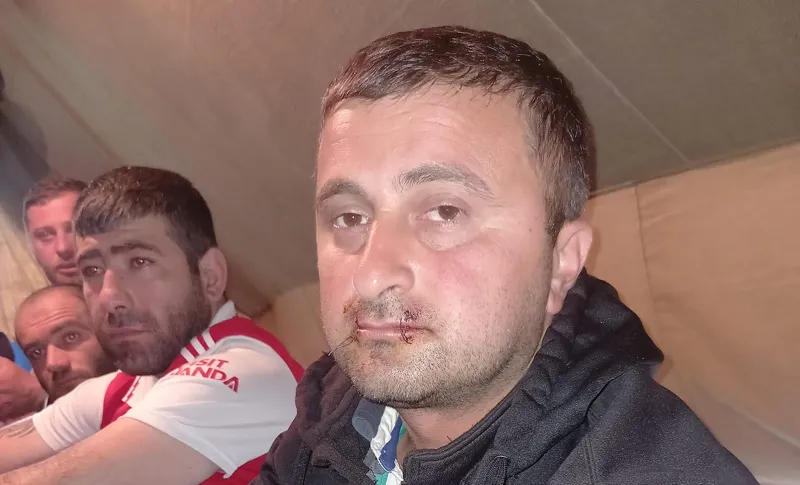 В Чиатуре один из шахтеров зашил себе рот