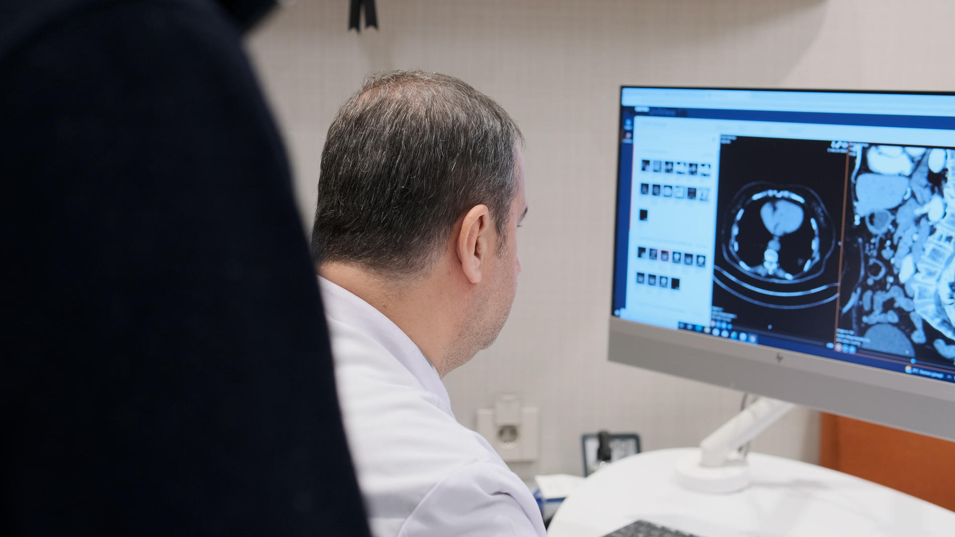 საუკეთესო ადგილი გასტროენტეროლოგიური ავთვისებიანი სიმსივნეების სამკურნალოდ