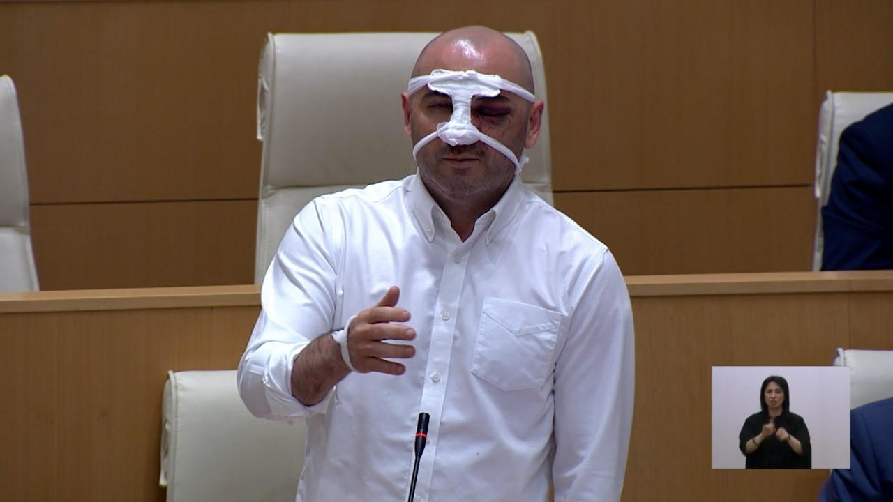 ლევან ხაბეიშვილი - როცა მირტყამდნენ მეუბნებოდნენ, „გრძელი ენა გაქვს, ხელისუფლებას მუდმივად აკრიტიკებ, იქნებ გაჩერდე“, ამბობდნენ, „მოკალით და მერე თქვით, რომ თავი დაარტყა“ - უნდოდათ მეთქვა, რომ „ჩმორი“ ვარ