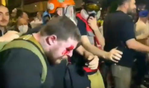 პარლამენტთან, სავარაუდოდ, რეზინის ტყვიების გასროლის შედეგად დაშავებული ერთ-ერთი პირი კლინიკაში გადაიყვანეს