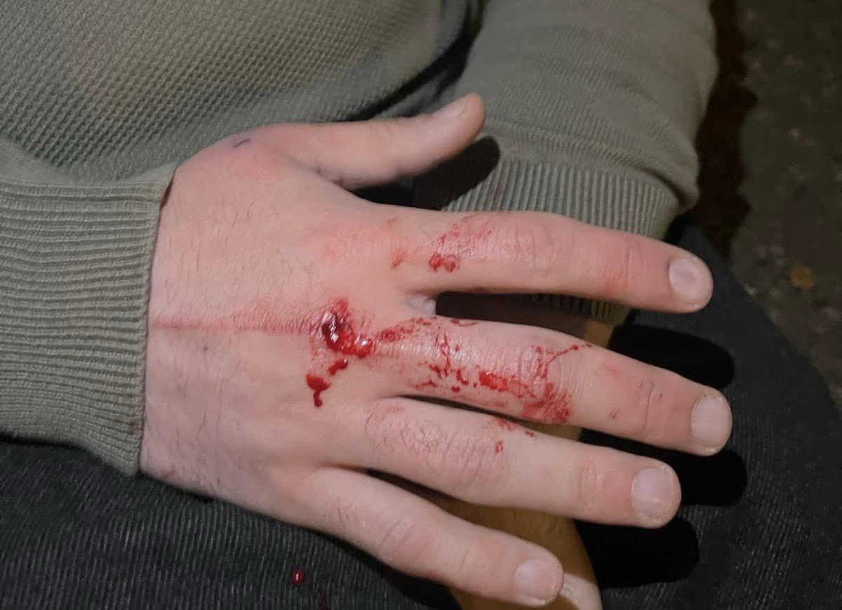 ზურაბ ჯაფარიძის ინფორმაციით, ბორის ჩელე ყურუას ფიზიკურად გაუსწორდნენ