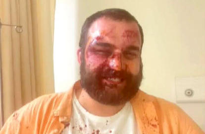 Dimitri Chikovani assaulted near his home
