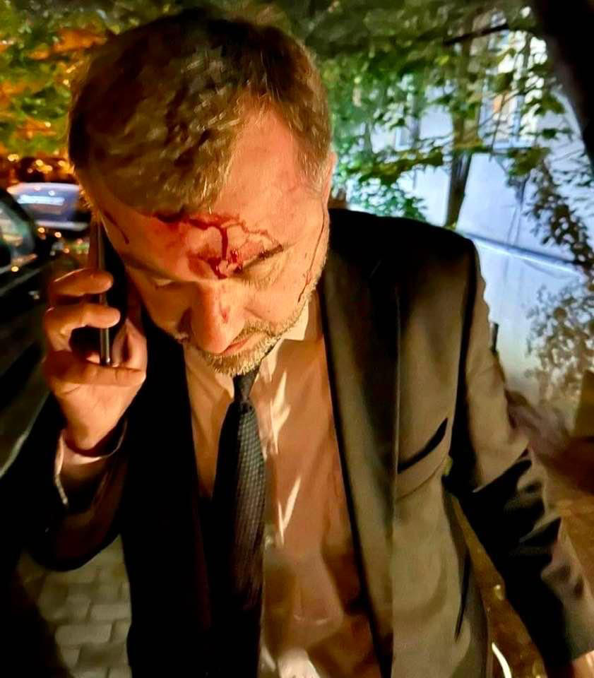 ზურაბ ჯაფარიძე - ჩემს ძმას სადარბაზოსთან რამდენიმე ადამიანი დახვდა და ფიზიკურად გაუსწორდა