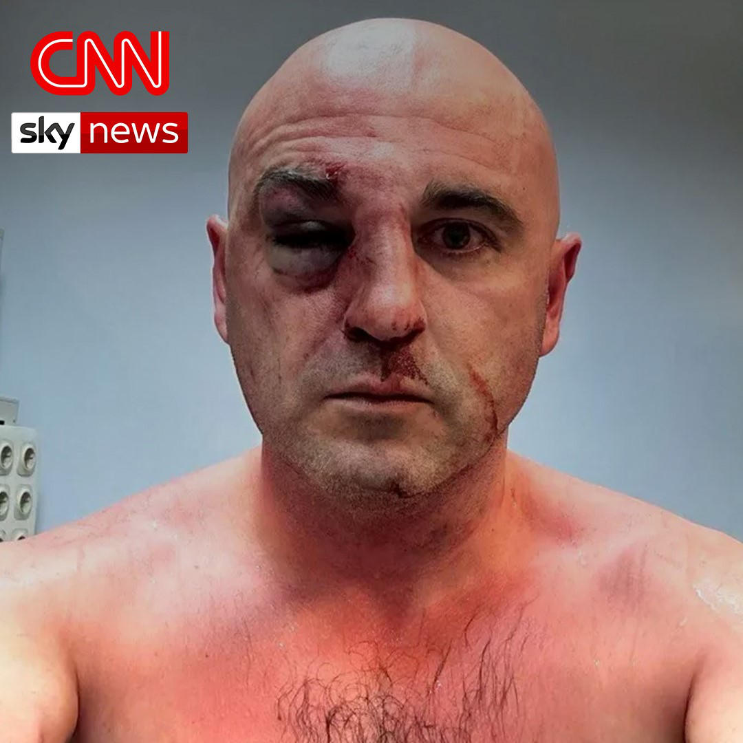 ლევან ხაბეიშვილი - ჩვენ თავისუფლებისთვის ბრძოლის არ გვეშინია, ჩვენ გვეშინია უკან, რუსეთში დაბრუნების