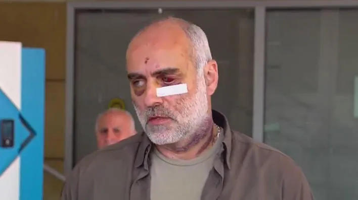 Davit Katsarava recalls details of his beating by riot police