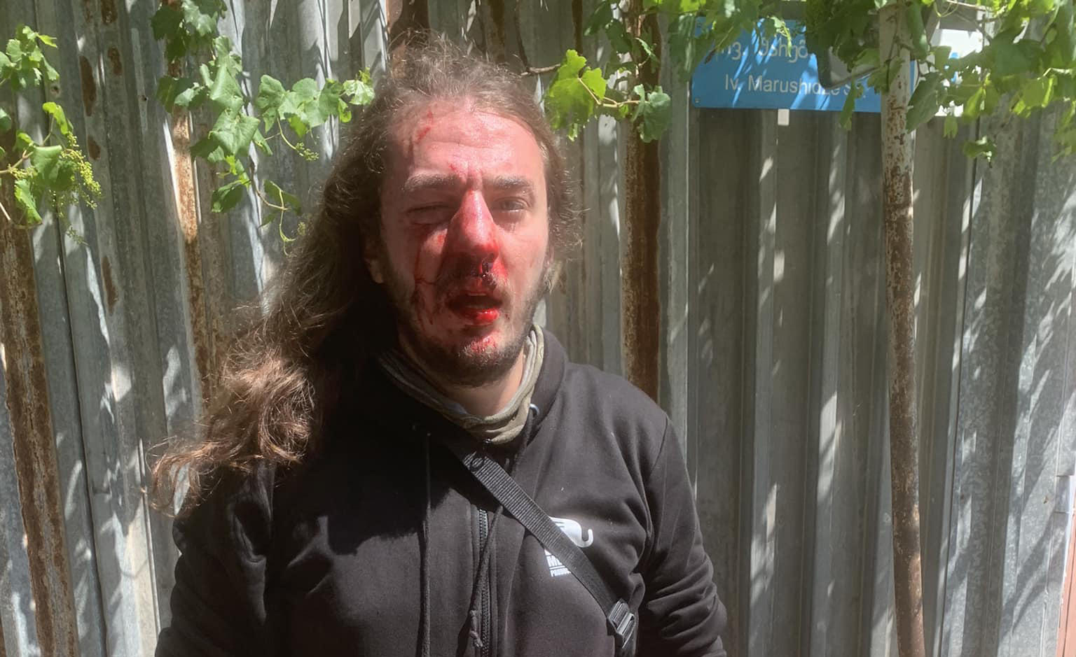 სამოქალაქო აქტივისტი, ზუკა ბერძენიშვილი სცემეს