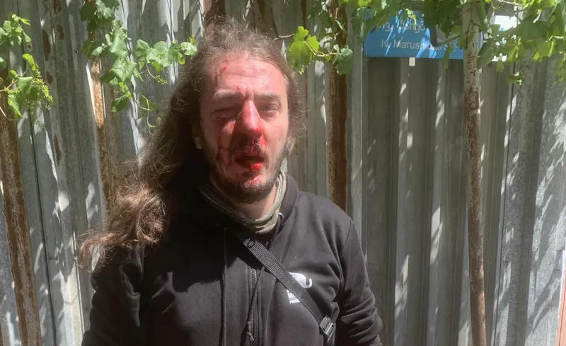 Избит гражданский активист Зука Бердзенишвили