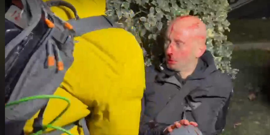 რუსთაველის გამზირზე საპროტესტო აქციაზე „ფორმულას“ ჟურნალისტი გურამ როგავა დაშავდა