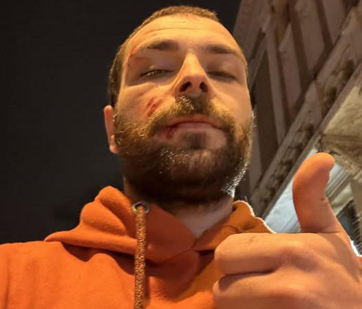 პრესსამსახურის ინფორმაციით, “კოალიცია ცვლილებისთვის” წევრს გელა ხასაიას საკუთარ სახლთან თავს დაესხნენ