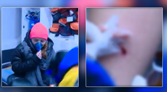 საპროტესტო აქციაზე „რუსთავი2“-ის ჟურნალისტი თამთა ჩიტიშვილი დაშავდა