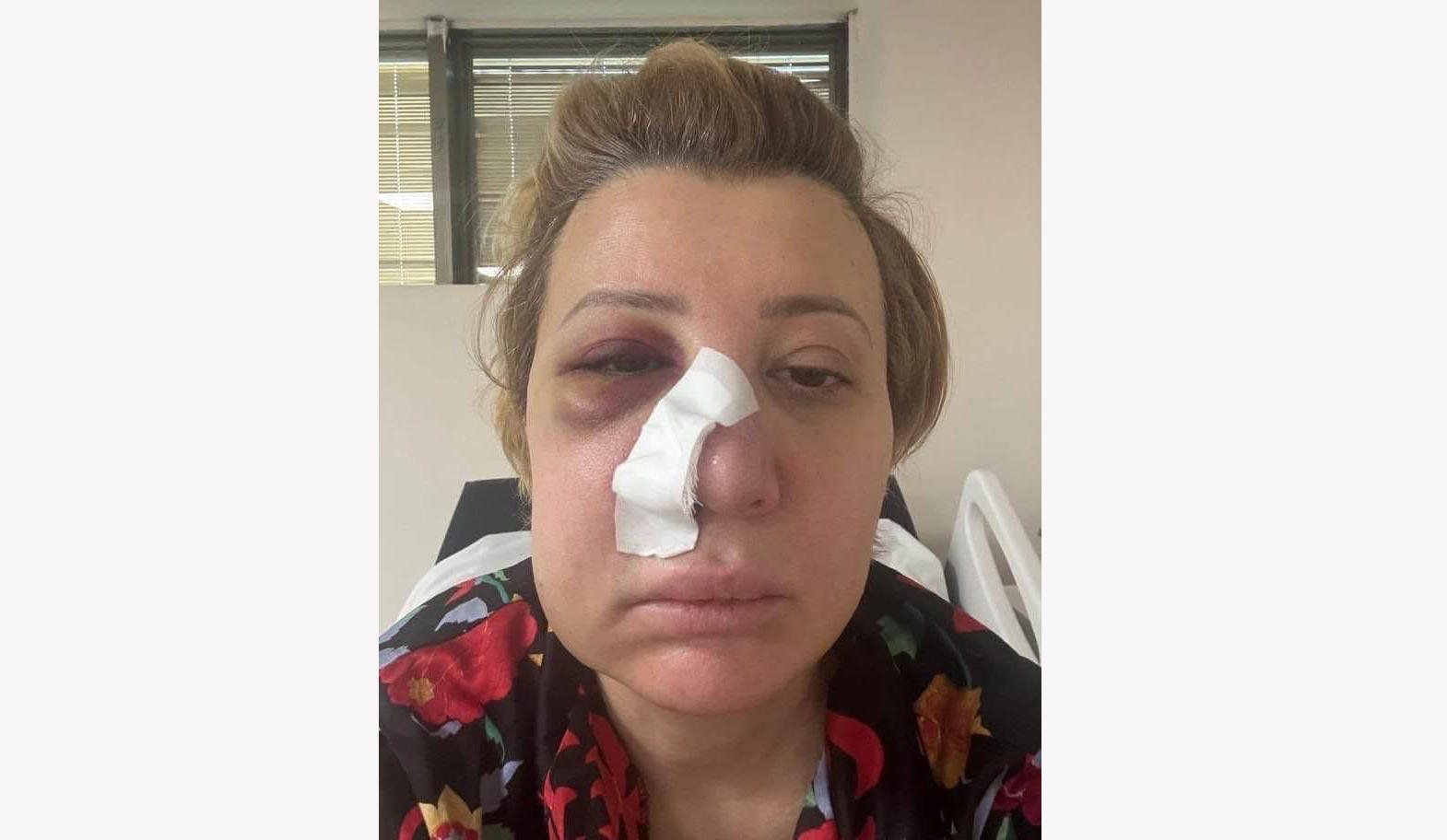 ნინო კვიტაიშვილი - მივიღე „ფორმა 100“, სადაც წერია - ყვრიმალისა და ზედა ყბის ძვლების მოტეხილობა, ცხვირის ძვლის მოტეხილობა და ჭრილობა - ფიზიკური ტკივილი უკან დაიხევს, ავიტან ნაიარევს, გავაგრძელებ ბრძოლას - გამოძიება კი - დუმს