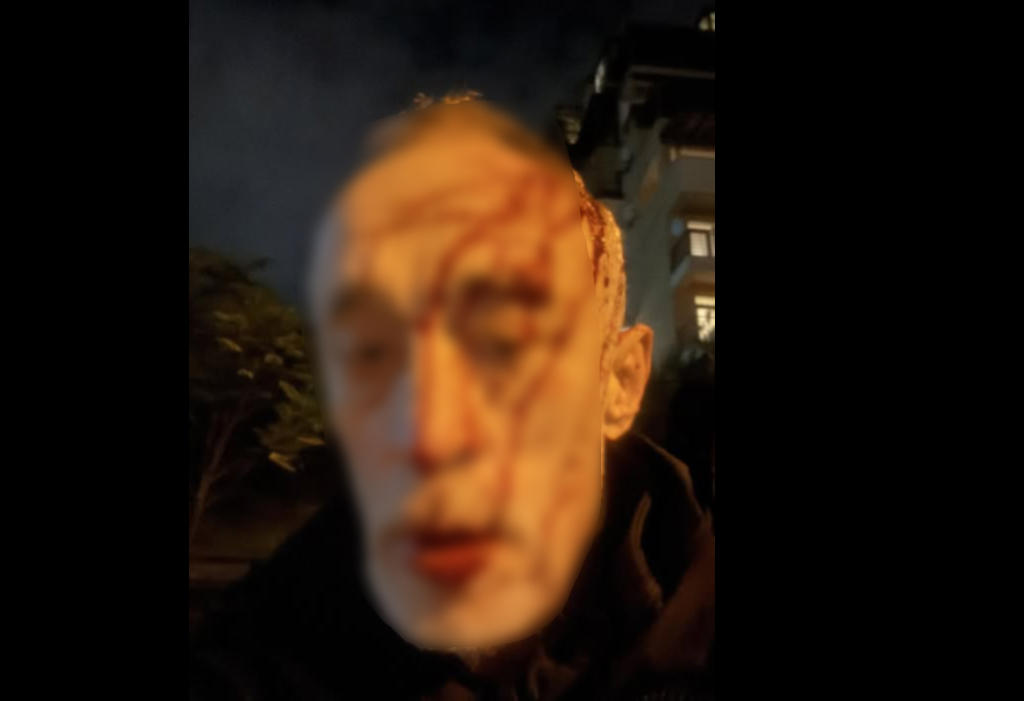 ნადიმ ხმალაძე აცხადებს, რომ მას რამდენიმე პირი დაესხა თავს